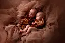 superbe photo de jumeaux à la naissance.webp