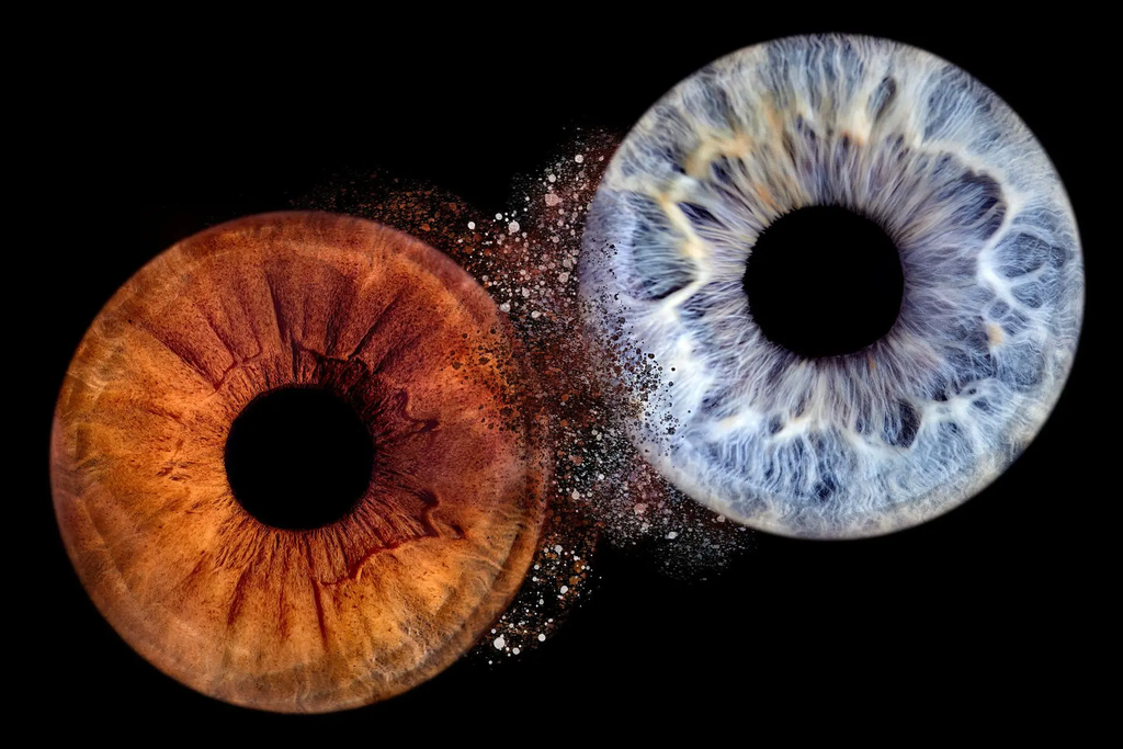 Type de rendez-vous 'Photo d'IRIS' cover image.webp